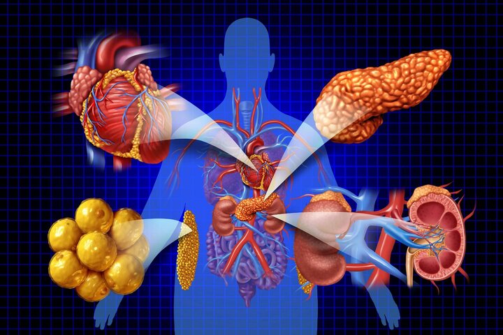 بیشتر مردم درمعرض ابتلا به یک بیماری مهم هستند؛ اما حتی نامش را هم نشنیده‌اند