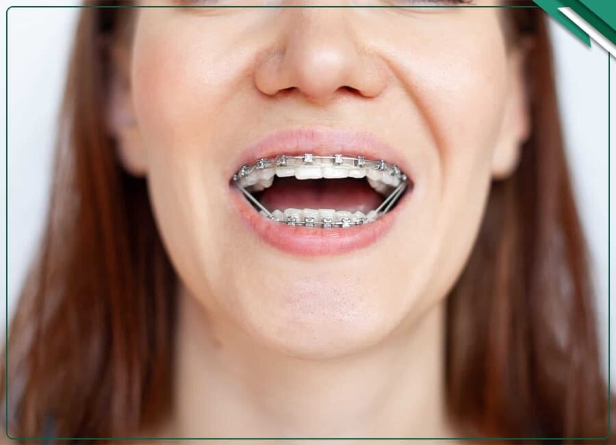 مرکز ارتودنسی شرق تهران