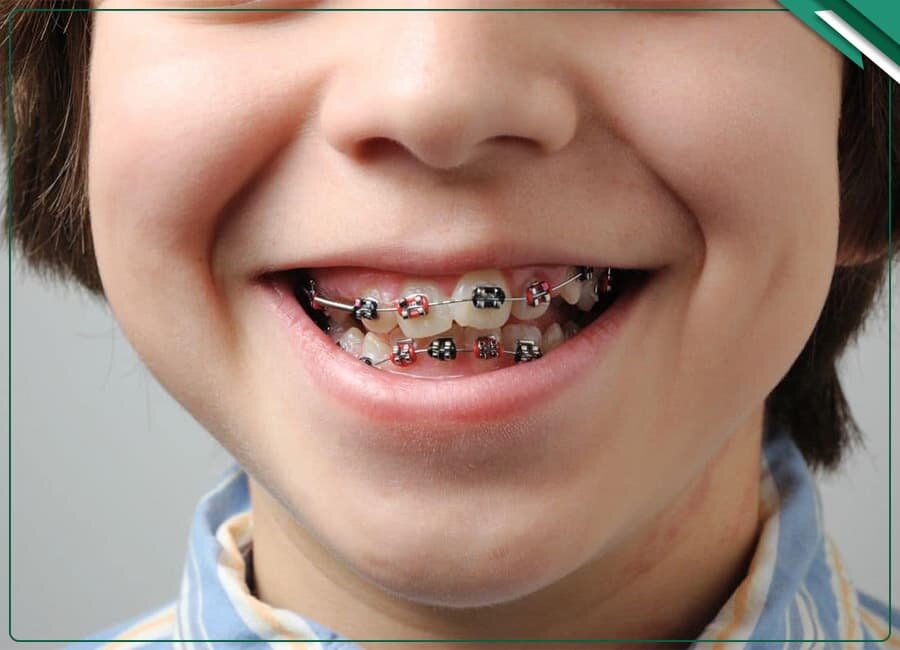 مرکز ارتودنسی غرب تهران