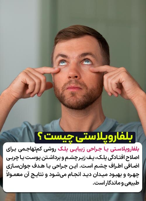 بلفاروپلاستی چیست ؟