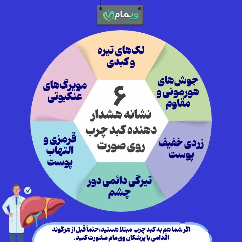 اینفوگرافی علائم کبد چرب در چهره