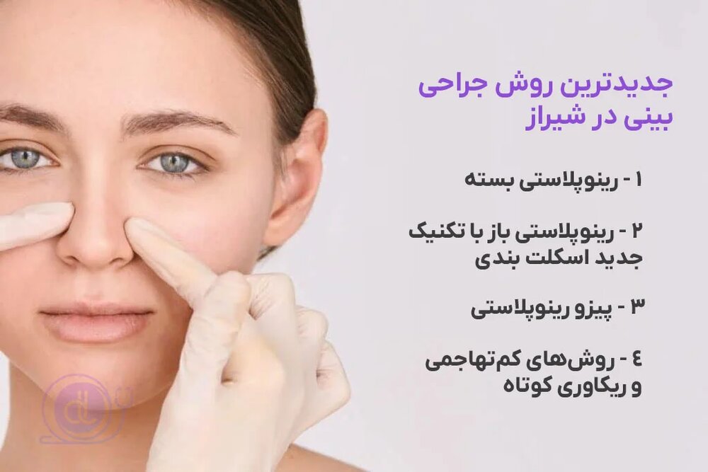 جدیدترین روش بینی در شیراز - doctorlands.com