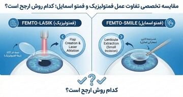 مقایسه تخصصی تفاوت عمل فمتولیزیک و فمتو اسمایل؛ کدام روش ارجح است؟