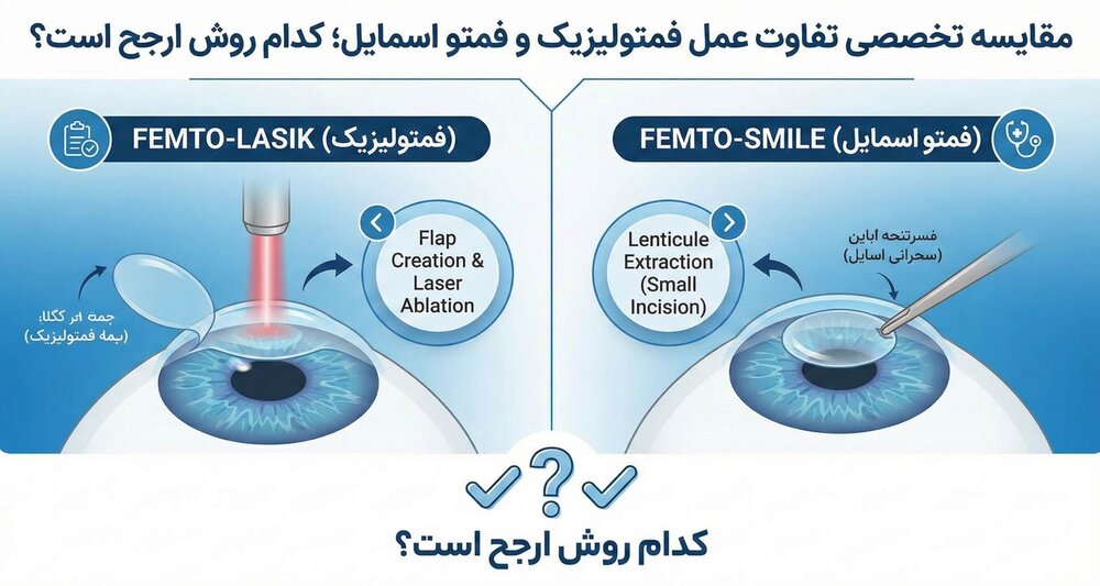 مقایسه تخصصی تفاوت عمل فمتولیزیک و فمتو اسمایل؛ کدام روش ارجح است؟