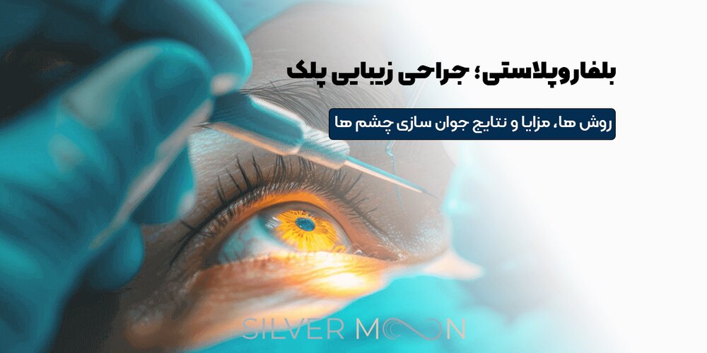 بلفاروپلاستی چیست؟ راهنمای جامع جراحی پلک برای جوان‌سازی چشم‌ها