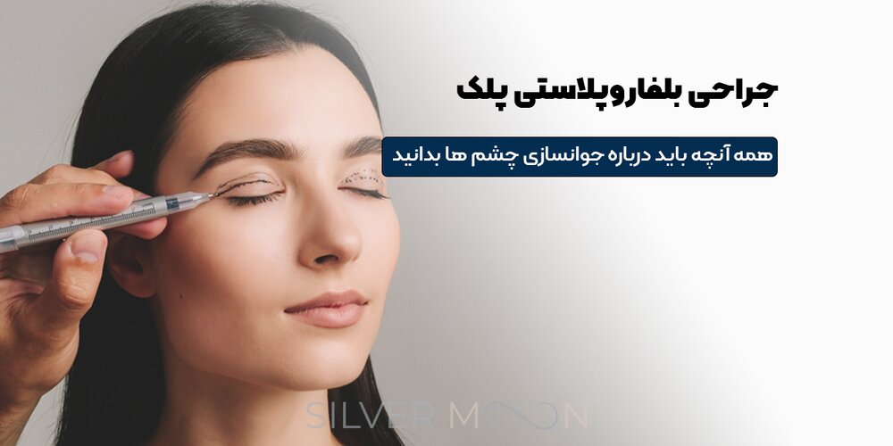 بلفاروپلاستی چیست؟ راهنمای جامع جراحی پلک برای جوان‌سازی چشم‌ها