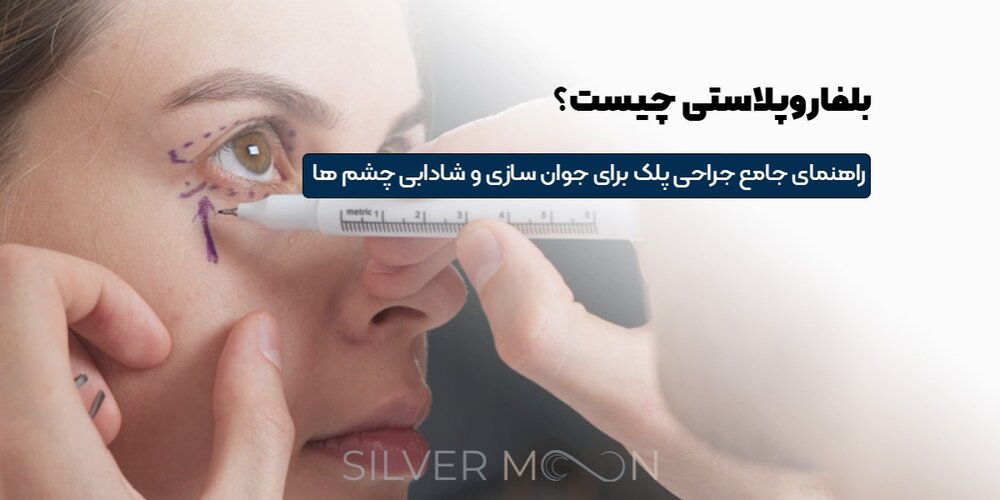 بلفاروپلاستی چیست؟ راهنمای جامع جراحی پلک برای جوان‌سازی چشم‌ها