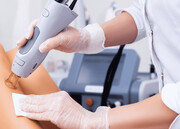 لیزر موهای زائد روی پوست آسیب دیده