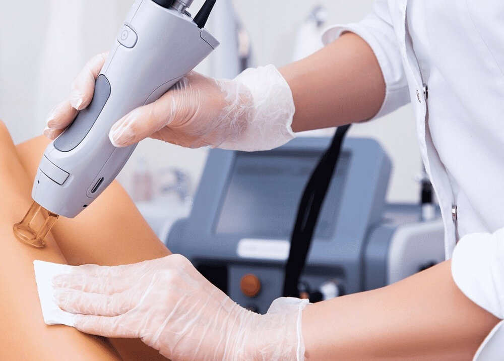 لیزر موهای زائد روی پوست آسیب دیده