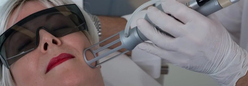 لیزر موهای زائد روی زخم