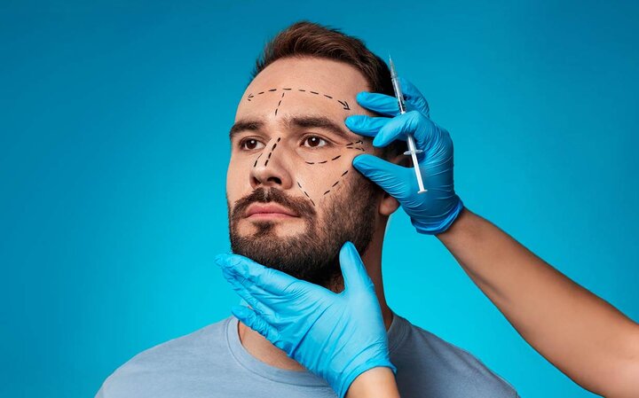 مراقبت بعد از بوتاکس ؛ راهنمای کامل برای کسب نتیجه دلخواه