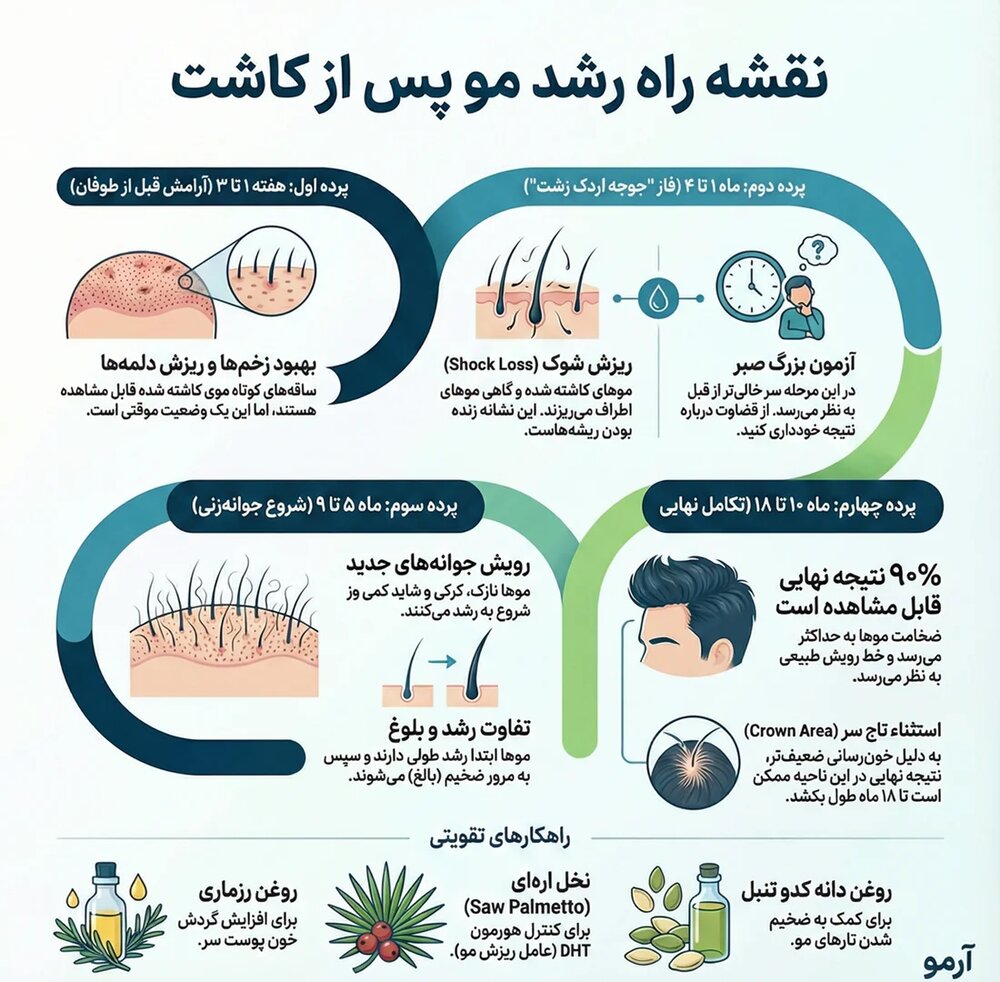 نتیجه کاشت مو کی و بعد از چند ماه مشخص می‌شود؟