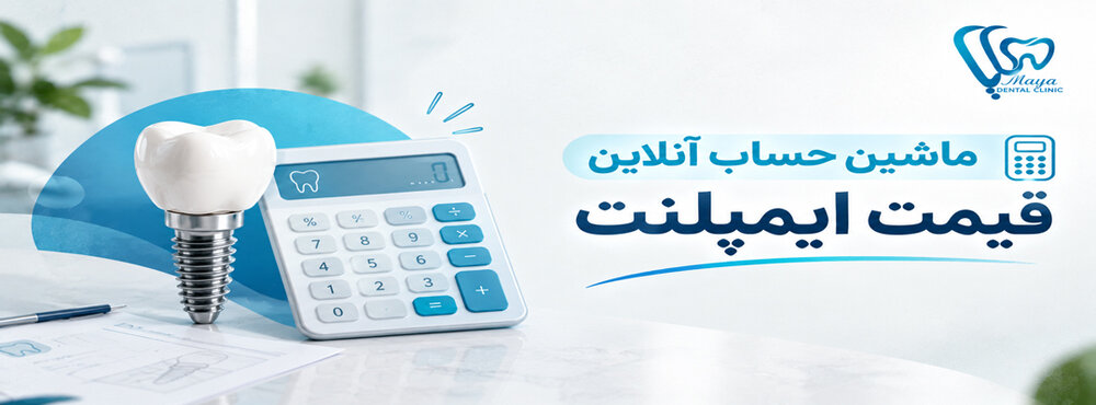 قیمت ایمپلنت دندان در تهران