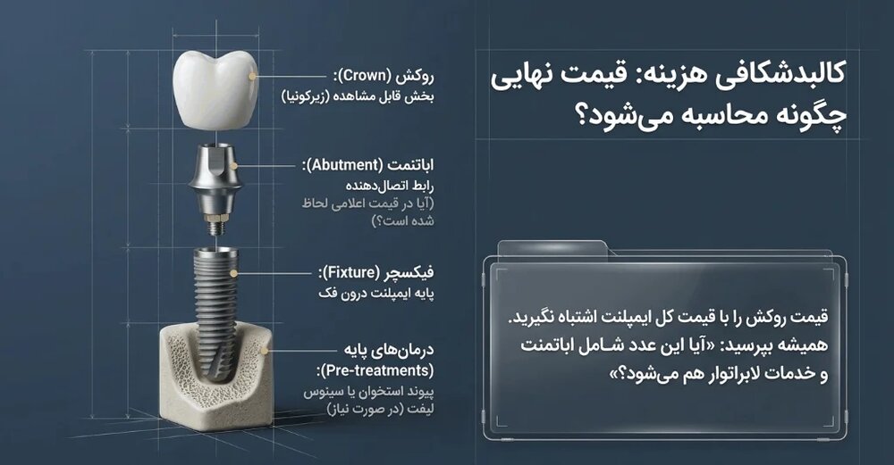 اجزای تشکیل‌دهنده هزینه و قیمت کل ایمپلنت و روکش زیرکونیا