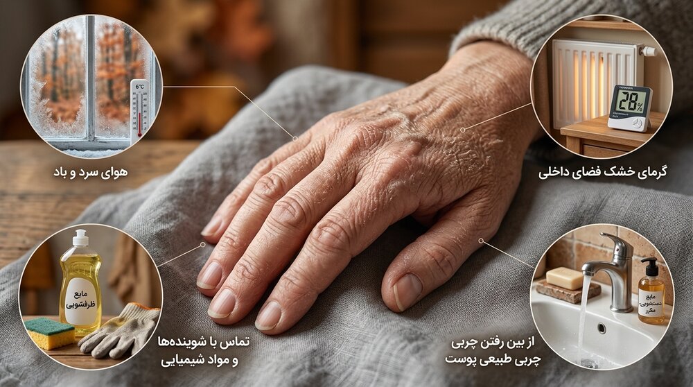 دلایل خشکی پوست دست در پاییز