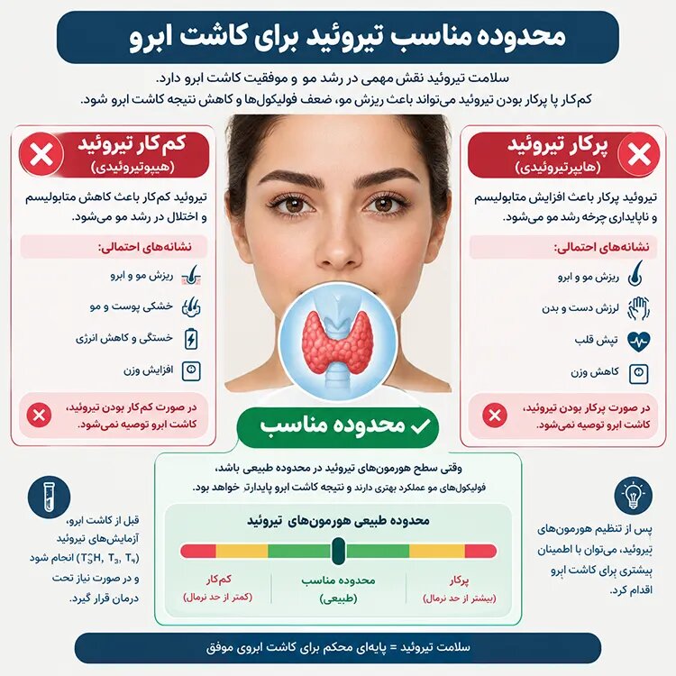 اختلال تیروئید و کاشت ابرو