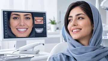 جدیدترین نمونه کار طراحی لبخند دیجیتال در کلینیک دکتر حسینی