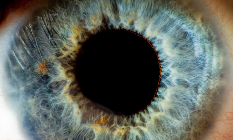 روش های درمان بیماری آب سیاه چشم