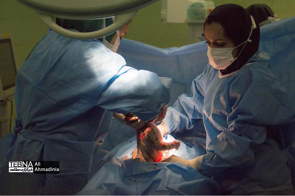 عمل سزارین در یکی از بیمارستان های تهران