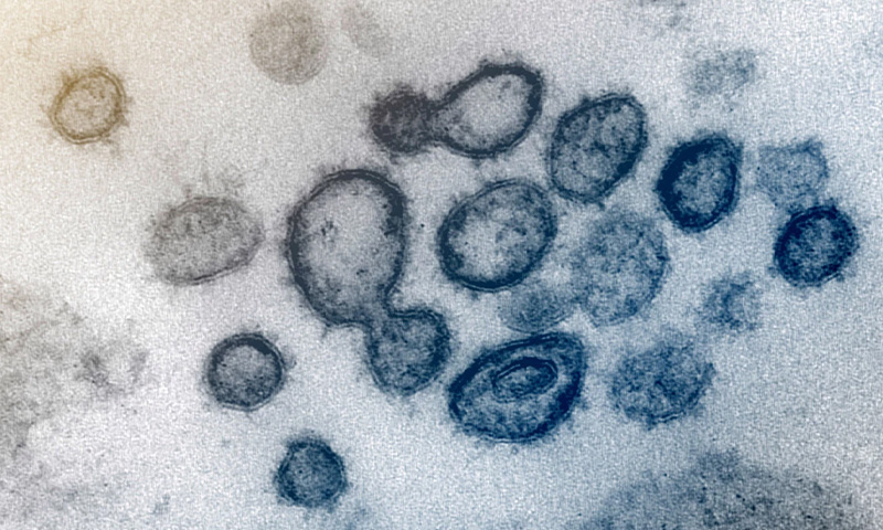 کروناویروس: واکسن این ویروس ممکن است تا پاییز آماده شود