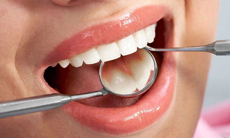 پریودنتیت دندان و روش های درمان آن