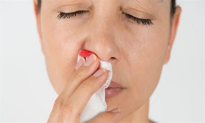 آیا خونریزی بینی هم از علائم کووید 19 است؟
