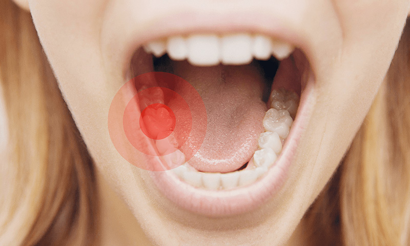پیشگیری از دندان درد و درمان های خانگی آن