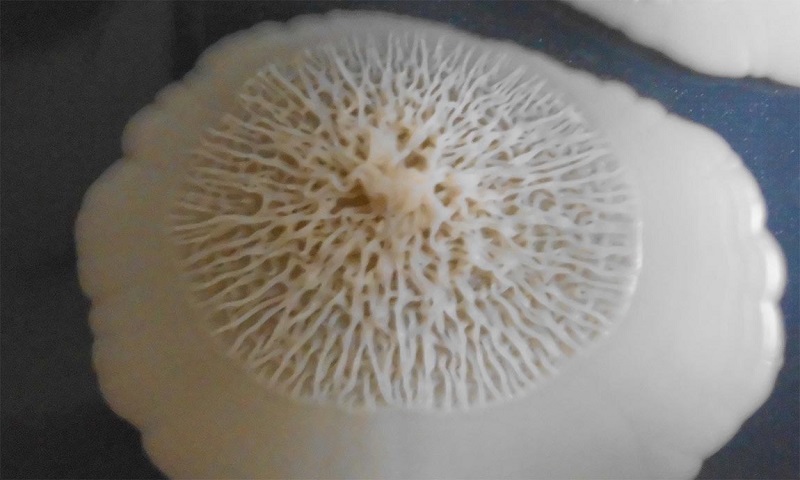 مصرف آنتی‌بیوتیک‌ چه نوع قارچی در بدن ایجاد می‌کند؟