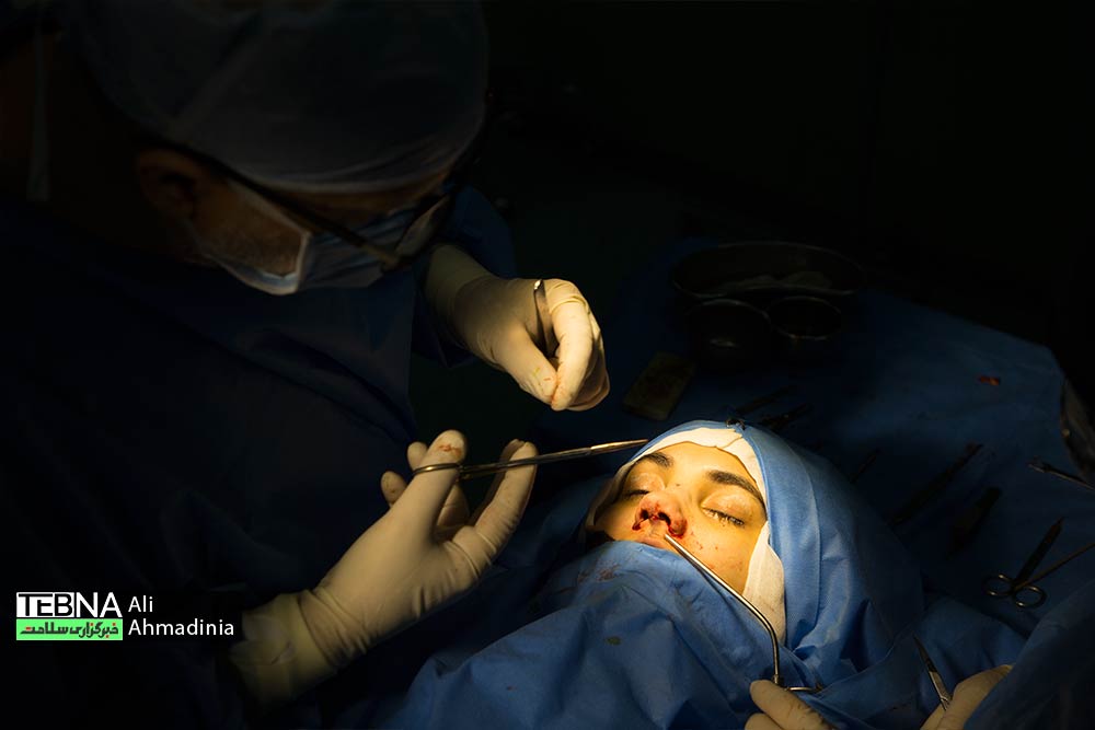 علت کج شدن بینی بعد از عمل جراحی بینی چیست؟