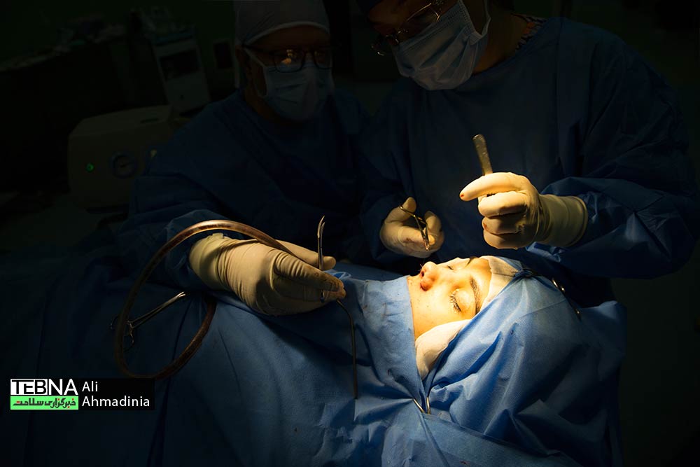عمل جراحی بینی؛ ضرورت درمانی یا فانتزی زیبایی
