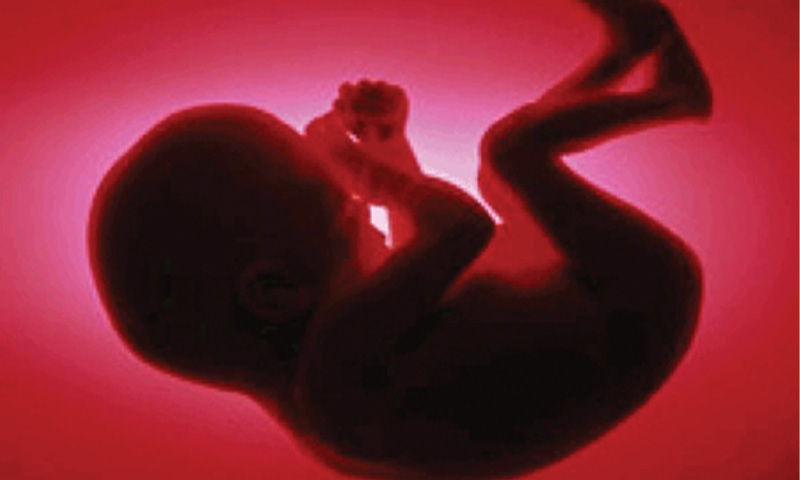 غربالگری جنین به هیچ عنوان اجباری نبوده است