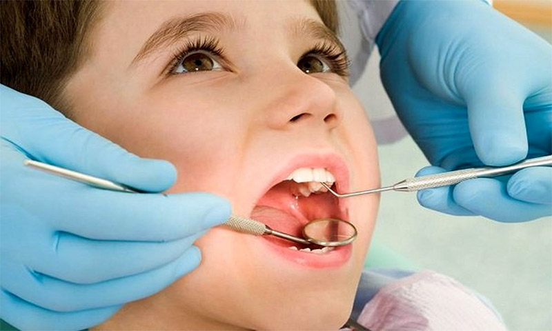 بیش از ۸۰ درصد کودکان زیر شش سال پوسیدگی دندان دارند