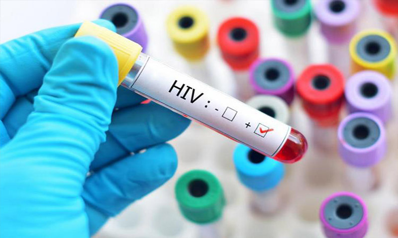 چگونه HIV به ایدز تبدیل می‌شود؟
